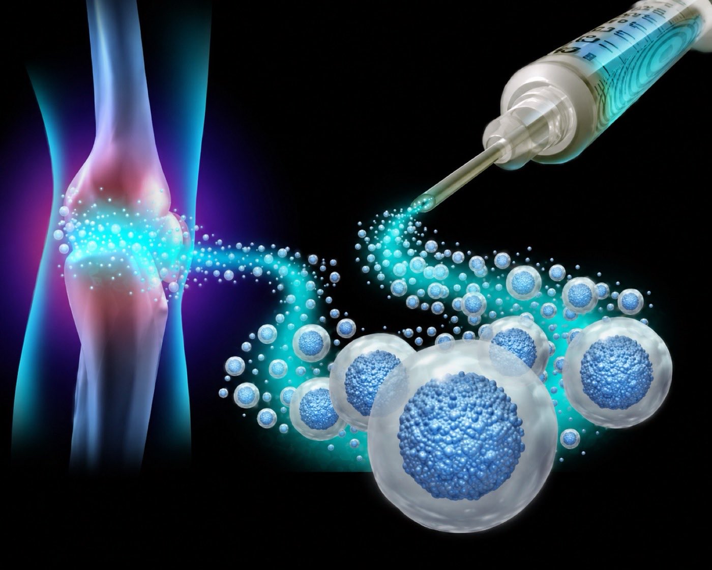 Knee joint regenerative treatment